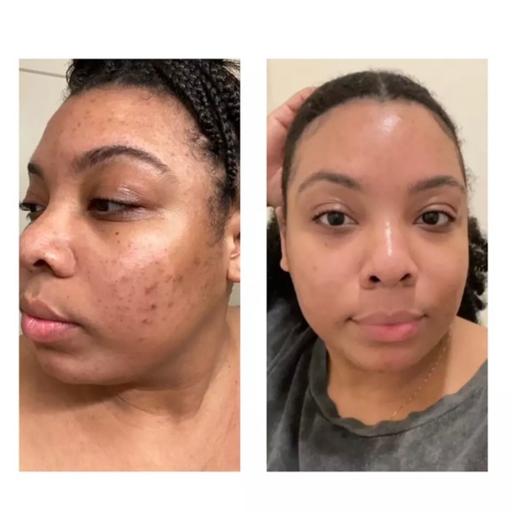 ✨Pick 5/$25- Rosen Skincare Super Smoothie Exfoliating Face Wash - Picture 4 of 4